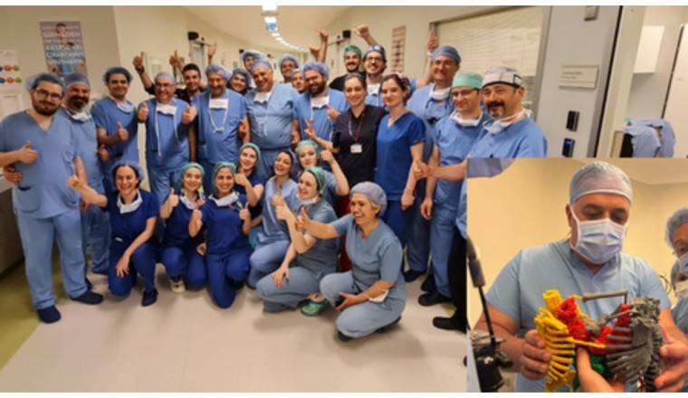 Turkish Medical Team Separates Conjoined Twins in 9 Hours, Breaking World Record