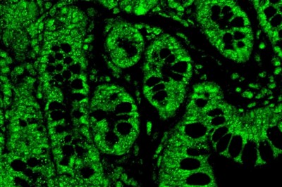 Tiny doses of THC show big benefits for HIV treatment